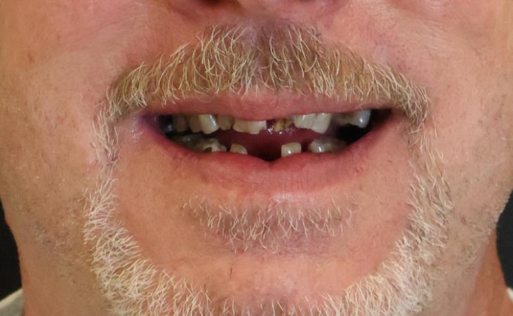 Before