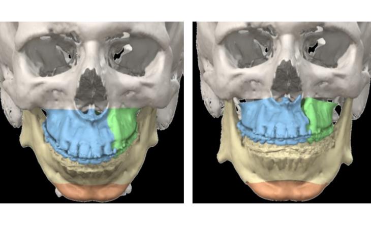 Preoperative vs Postoperative