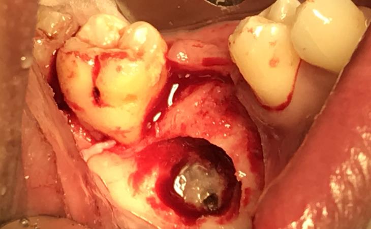 Pathology Before and After Case #1 