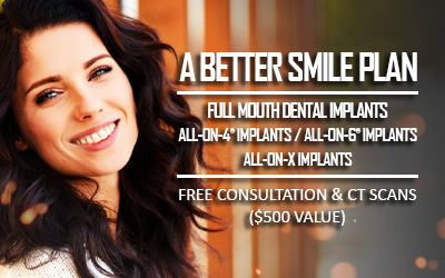 hybrid dental implants